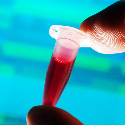 Servicio de autenticación de tercera persona de prueba de los laboratorios de la detección de la comida del biberón rápido aprobado por la FDA del contacto